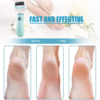 Electric Foot Grinder Dead Skin Remover Feet Scrubber Callus Pedicure Shaver Remove Dry Dead Cracked Foot Care Repair Tool